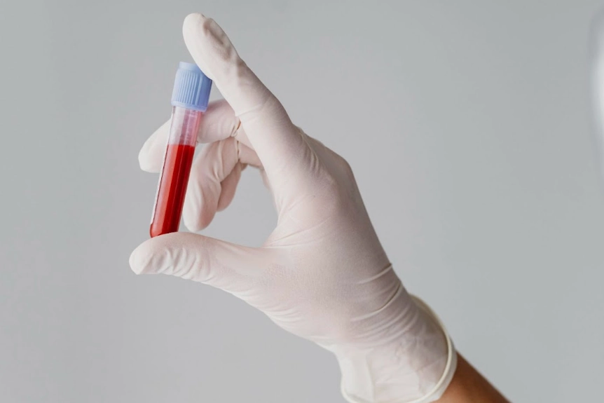 Photo credit: Freepik